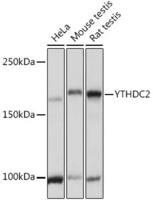 Western Blot: YTHDC2 Antibody [NBP2-95159] - Western blot analysis of extracts of various cell lines, using YTHDC2 Rabbit pAb (NBP2-95159) at 1:3000 dilution. Secondary antibody: HRP Goat Anti-Rabbit IgG (H+L) at 1:10000 dilution. Lysates/proteins: 25ug per lane. Blocking buffer: 3% nonfat dry milk in TBST. Detection: ECL Basic Kit. Exposure time: 1s.
